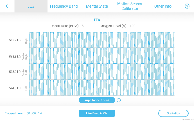 20230215_Website_Media Kit_2_App Images_MindViewer Item 2_640x400_EN